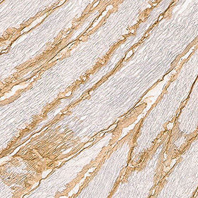 Monoklonaler Antikörper - B-DG-CE - Leica Biosystems - Diagnose / Immunohistochimie / für Immunotestverfahren