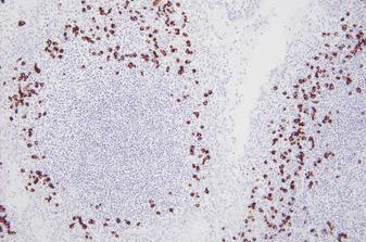 Reaktives Milieu - PB0669 - Leica Biosystems - Immunohistochimie