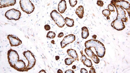 Antikörper - PA0416-U - Leica Biosystems - monoklonaler Antikörper / für die Histopathologie / Immunohistochimie