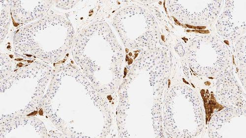 Antikörper - CALRET566-L-CE - Leica Biosystems - monoklonaler Antikörper / Diagnose / Immunohistochimie