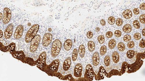 Antikörper - CEA-609-L-CE - Leica Biosystems - monoklonaler Antikörper / Immunohistochimie / Diagnose