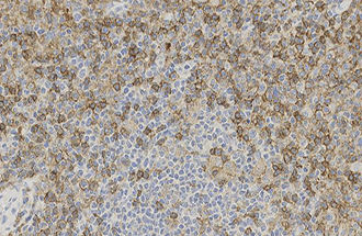 Monoklonaler Antikörper - CD4 - Leica Biosystems - Antikörper / für die Histopathologie / Immunohistochimie