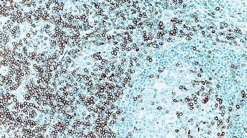 Antikörper - CD5 - Leica Biosystems - monoklonaler Antikörper / Immunohistochimie / für die Histopathologie