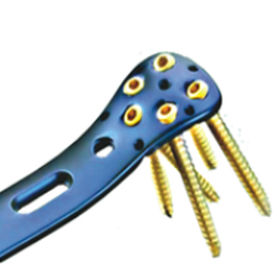 Kompressionsplatte für Oberschenkelknochen - ORTHO CARE - proximal / Metall