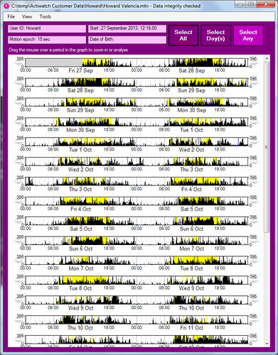 Software für Kliniken - MotionWare - CamNtech - Analyse / Datenverwaltung / Telemonitoring für körperliche Aktivität