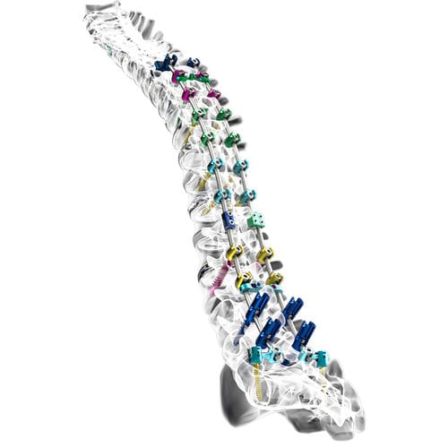 Thorako-lumbales Stabilisierungssystem für Osteosynthese - INERTIA® - Nexxt Spine - dorsaler Zugang / für Erwachsene