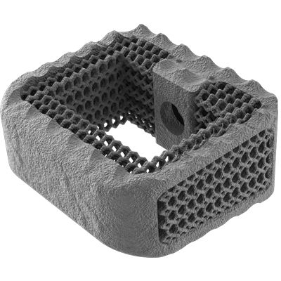 HWS-Zwischenwirbelimplantat - NEXXT MATRIXX® - Nexxt Spine - ventraler Zugang / Titan
