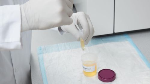 Testkit für Fentanyl - ARK™  - Siemens Healthineers - Laboratory Diagnostics - für Missbrauchsdrogen / Urin
