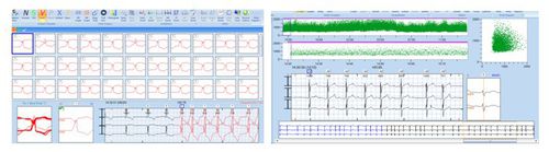 Analysesoftware - CardioTrak  - Beneware Medical Equipment - für Langzeit-EKG / medizinisch