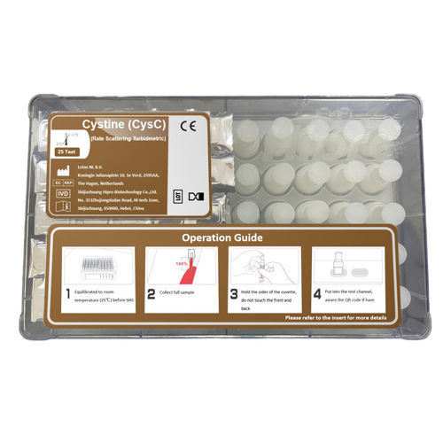 Testkit / Cystatin C - Hipro Biotechnology Co., Ltd. - Nierenkrankheiten / Serum / Plasma