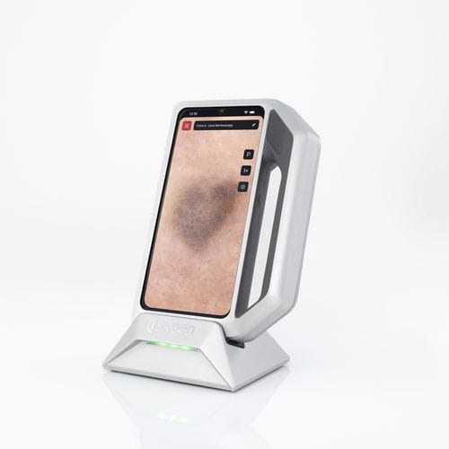 Videodermatoskop - FotoFinder Systems - weiße LED