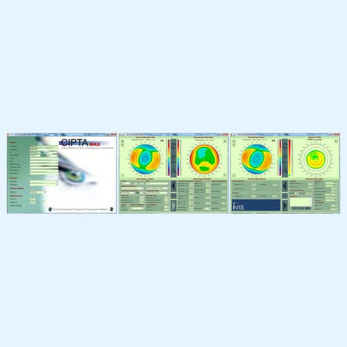 Behandlungsplanungssoftware - CIPTA® - iVis Technologies - Präoperative Planung / Projektentwicklung / medizinisch