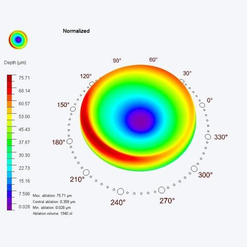 Medizinisches Software-Modul - PresbyMAX® - SCHWIND eye-tech-solutions - für Ophthalmologie / Behandlungsplanung / Auge