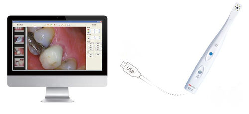 Intraorale Kamera - SuperVista-----HDI-210 - Handy Technologies - digital / CMOS / USB