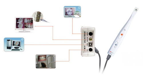 Intraorale Kamera - CamAssist-----HDI-300/400A - Handy Technologies - digital / CCD