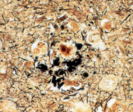 Färbelösungs-Reagenz - Bielschowsky   - BIO-OPTICA Milano - für Zytologie / für die Histologie