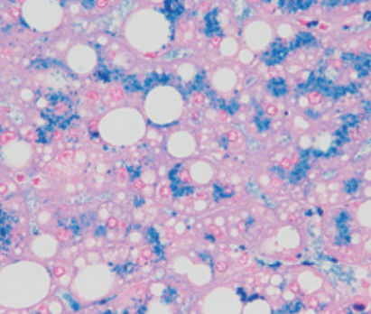 Färbelösungs-Reagenz - Perls - BIO-OPTICA Milano - für die Histologie / für Zytologie