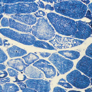 Färbelösungs-Reagenz - 30-30116LY  - BIO-OPTICA Milano - für die Histologie
