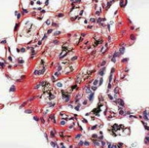 Färbelösungs-Reagenz - Sirius Red - BIO-OPTICA Milano - für Zytologie / für die Histologie