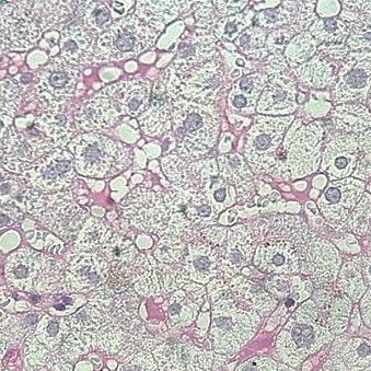 Färbelösungs-Reagenz - P.A.S. – A  - BIO-OPTICA Milano - für Zytologie / für die Histologie