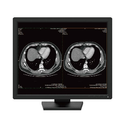 Diagnose-Monitor - R191 - Nanjing Jusha Display Technology - 1280 x 1024 / 19" / mit LED-Hintergrundbeleuchtung