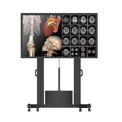 Medizinisch Monitor - S8420 - Nanjing Jusha Display Technology - Mammographie / 3840 × 2160 / 84"