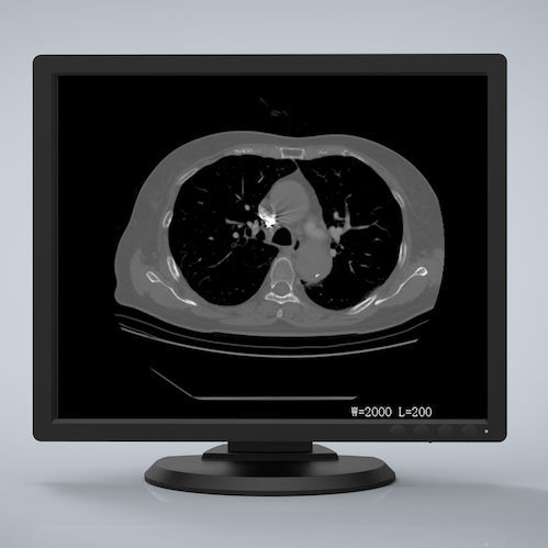 Medizinisch Monitor - R193G - Nanjing Jusha Display Technology - 1280 x 1024 / LCD / LED