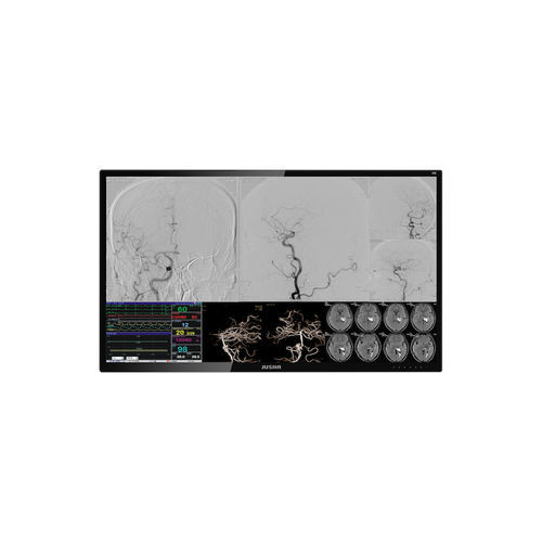 Monitor für OP-Bereich - E550EG - Nanjing Jusha Display Technology - für Endoskopie / 3840 × 2160 / Fern