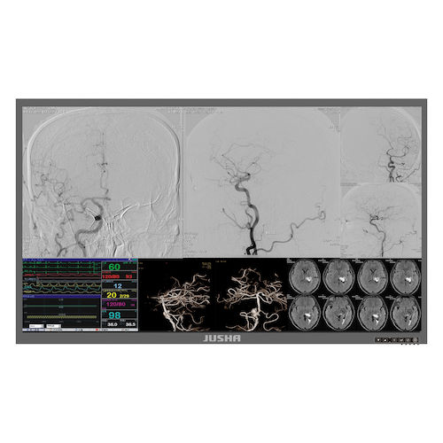 Medizinisch Monitor - S5810 - Nanjing Jusha Display Technology - OP / 3840 × 2160 / 58"