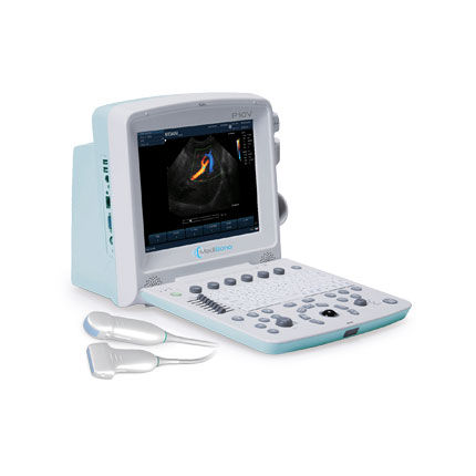 Tragbares Tierärztliches Ultraschallsystem - P10V - MediSono - Multifunktion