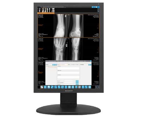 Messmodul für Software - iQ-4VIEW - IMAGE Information Systems - Viewer / Diagnose / Reporting