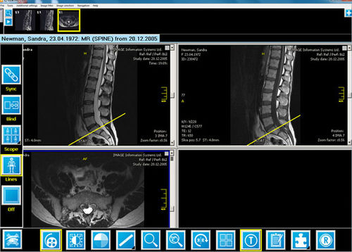 Software für Radiologie - iQ-VIEW/PRO - IMAGE Information Systems - für Nuklearmedizin / Reporting / Visualisierung