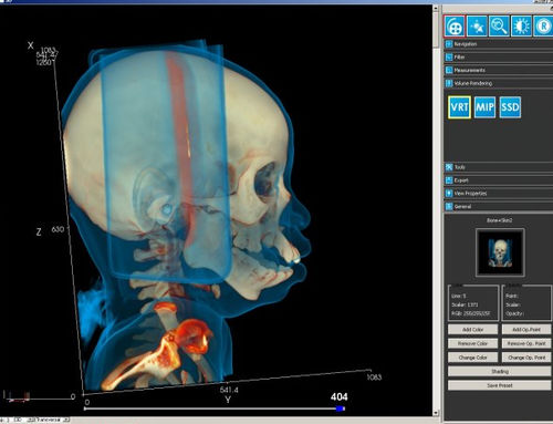 Software-Modul / für medizinische Bildgebung - iQ-3D - IMAGE Information Systems - 3D-Visualisierung / Nachbearbeitung / für Tablet-PC
