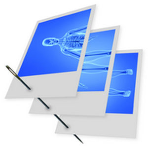 Software für orthopädische Bildgebung - Stitching  - IMAGE Information Systems - für Veterinärbildgebung / Datenverwaltung / Beschaffung