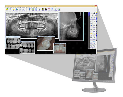 Software für dentale Bildgebung - LED Dental - Dental / Visualisierung / Analyse