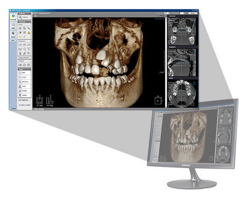 Software für dentale Bildgebung - Xelis 3D - LED Dental - Dental / 3D-Visualisierung / Analyse