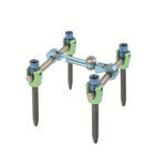 thorako-lumbales Stabilisierungssystem f&uuml;r Osteosynthese