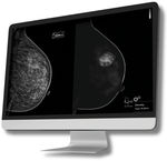 Computerprogramm für Mammographie-Tomosynthese