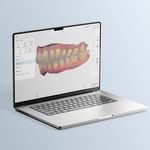 Software f&uuml;r intra-oral-Scanner