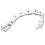 Aligner