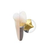 Implantat-Abutment / Titan