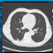 AnalysesoftwareVAREX Imaging