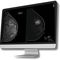 Computerprogramm für Mammographie-TomosyntheseBreast-SlimView&reg;Hera-MI