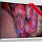 medizinischer MonitorEndoVue PlusNDS Surgical Imaging