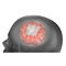 Dura Mater Substitutions-Prothese / Achillessehne der RinderDuraMatrix Stryker