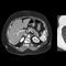 medizinische SoftwarePIQECanon Medical Systems Europe