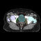 medizinische KI-PlattformVarian Oncology