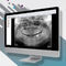 VisualisierungssoftwareOMSCarestream Dental