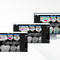 VisualisierungssoftwarePearl's Second Opinion&reg;Carestream Dental