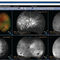 Software f&uuml;r OphthalmologieOptosAdvanceOptos